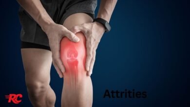 Attrities