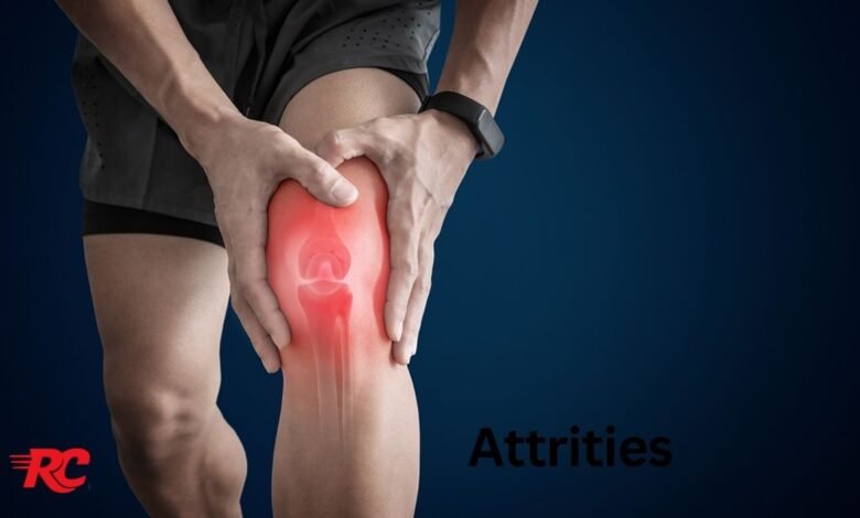 Attrities